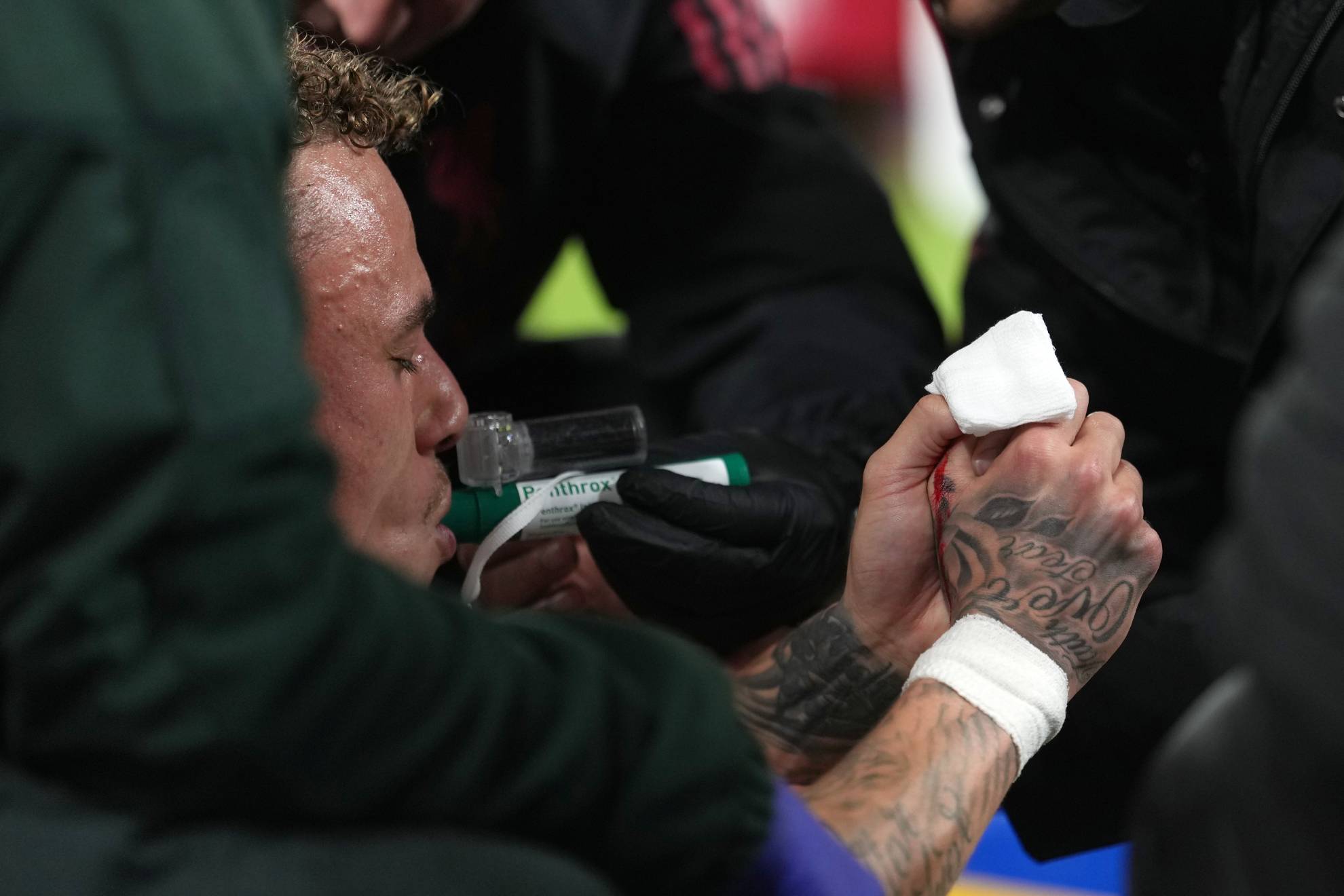 Terror en Anfield: Noa Lang sufre la amputación parcial de un dedo tras quedar atrapado en la valla